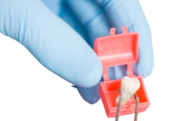 Treatment Options for a Loose Tooth​
