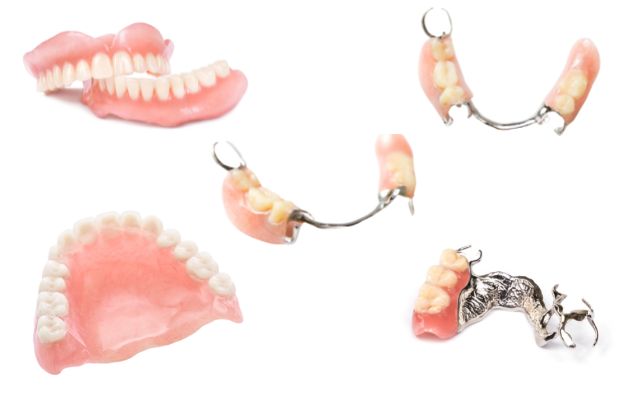 Các loại răng giả