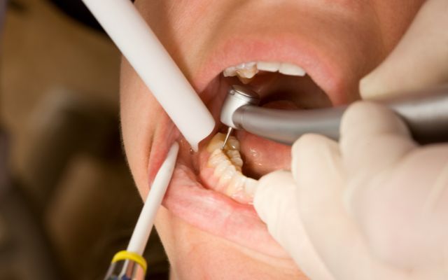 Điều trị tủy răng đau không