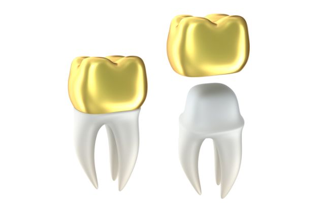 Gold dental Crowns 