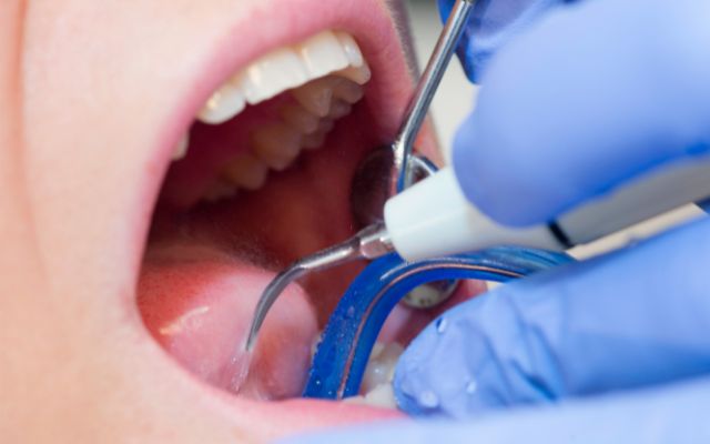 what is Dental Trauma