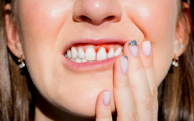 At-Home Stop The Bleeding Gums​