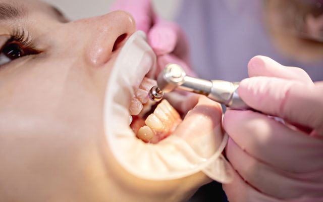 4 bước làm răng đính đá tại nha khoa