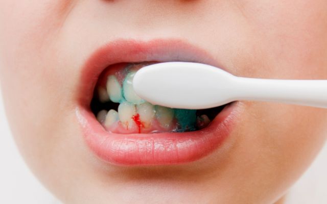 Why Do My Gums Bleed When I Brush My Teeth?