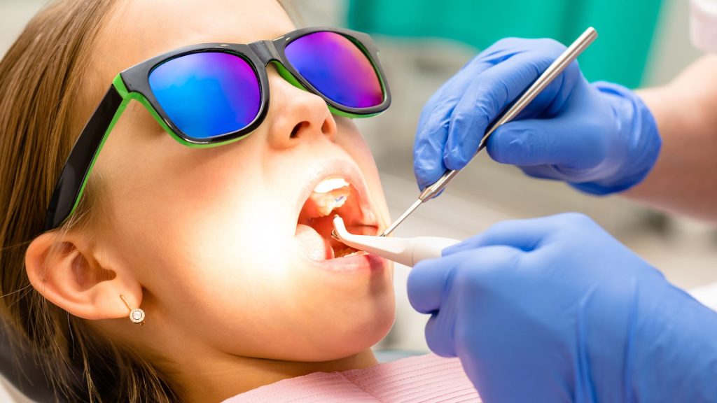 Fluoride Treatment At Spring Orchid Dental Clinic
