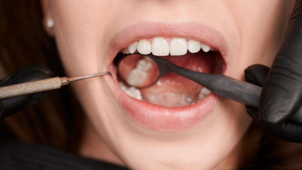 Benefits of Teeth Reshaping