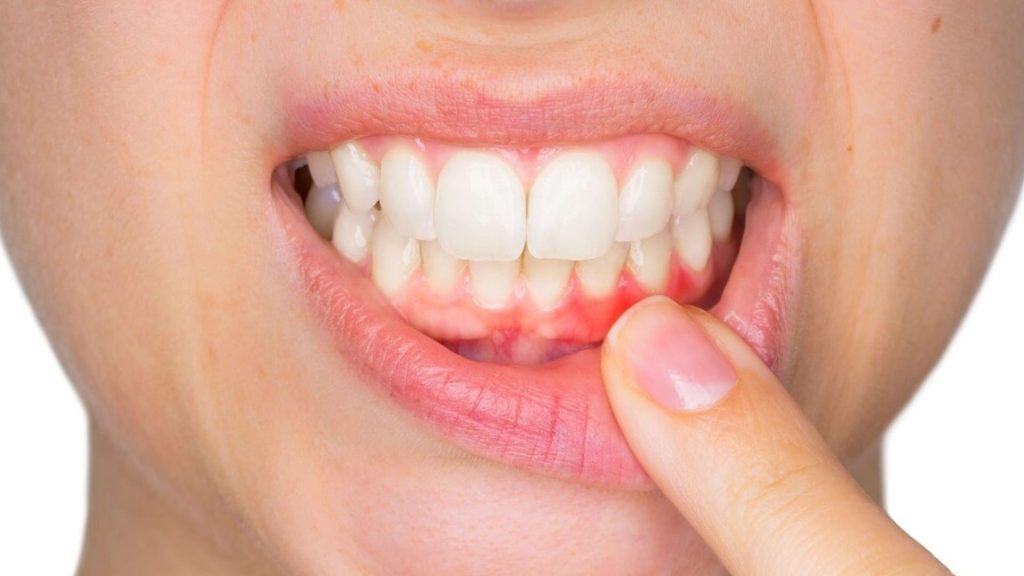 What Occurs Without Periodontal Treatment?