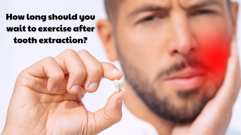 How Long Should You Wait To Exercise After Tooth Extraction?