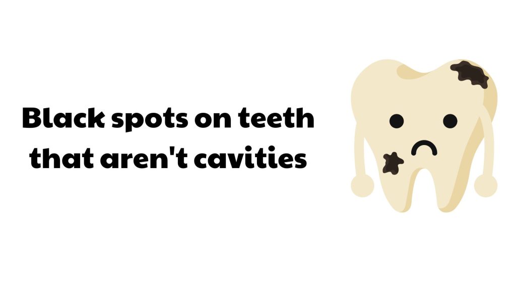 Black Spots On Teeth That Aren't Cavities