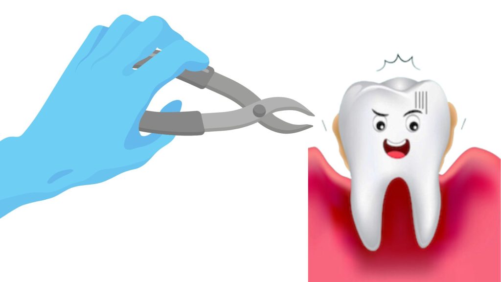 Does Gum Disease Go Away When Teeth Are Removed