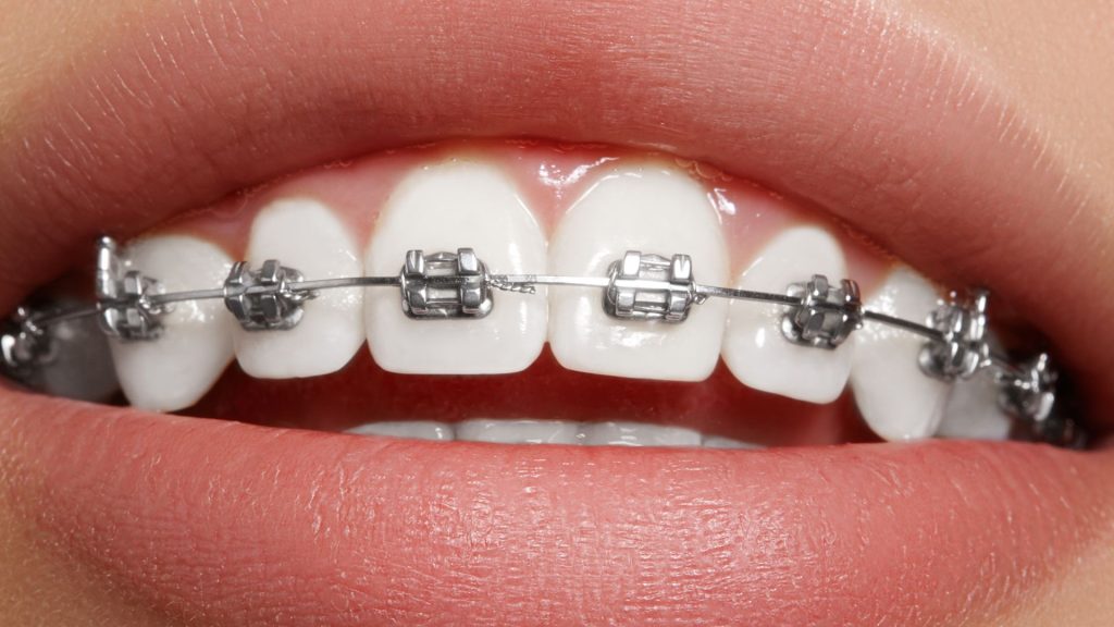 Australian Orthodontics Introduction