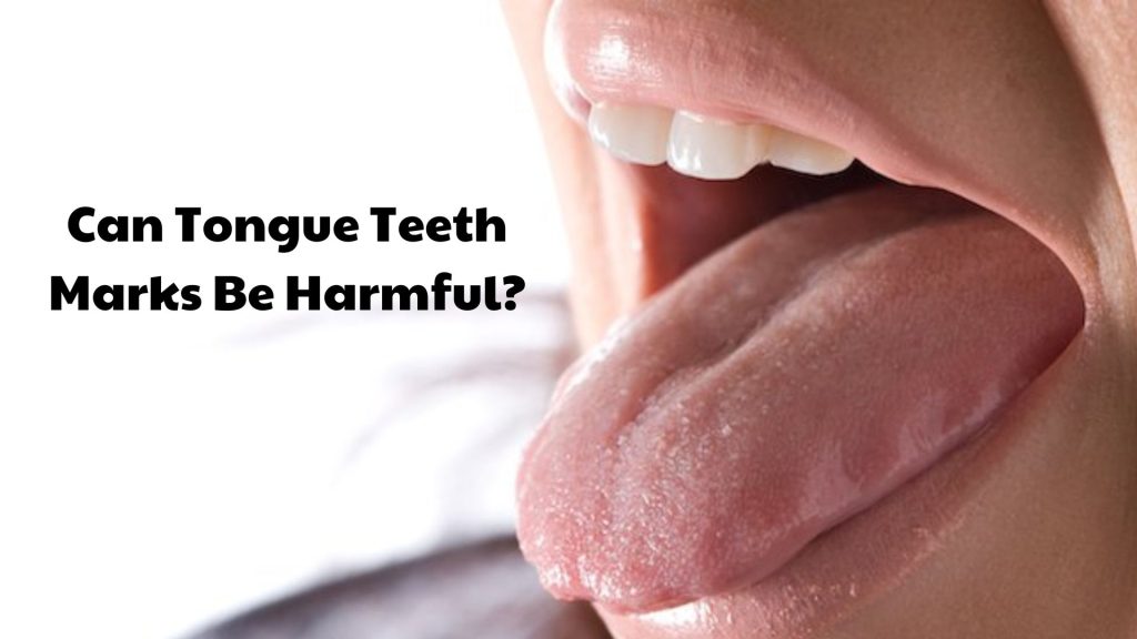 Can Tongue Teeth Marks Be Harmful