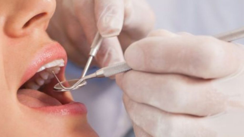 Dental Services At Spring Orchid Dental Clinic