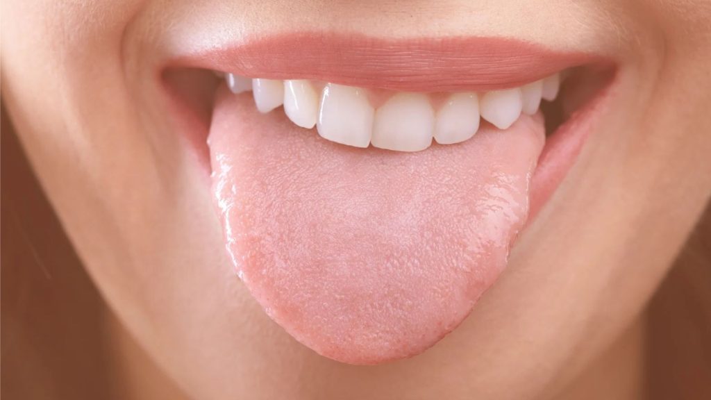 Teeth Marks On Tongue