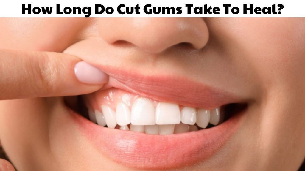 How Long Do Cut Gums Take To Heal