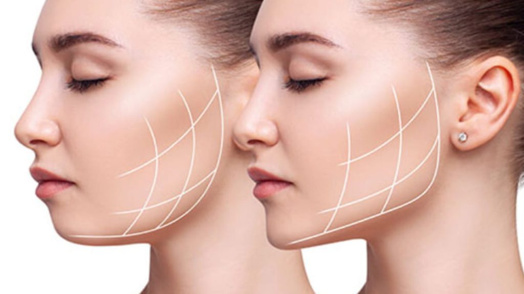 How To Improve Jawline Effectively And Safely