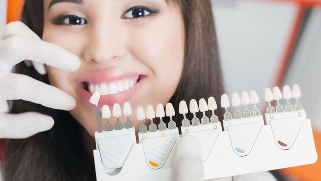 How to Choose the Best Ceramic Teeth Color?