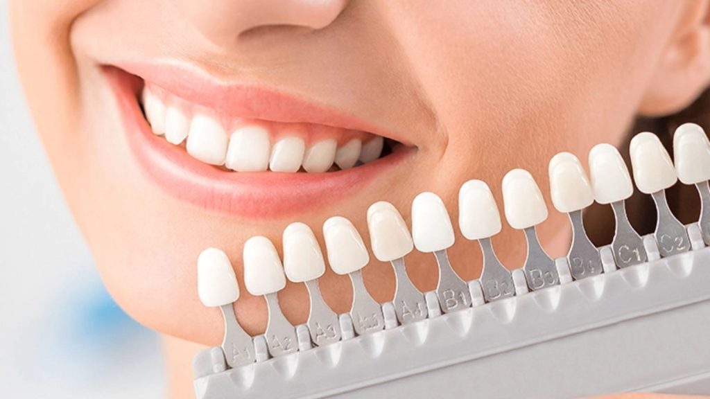 What Is The Whitest Shade Of Natural & Artificial Teeth