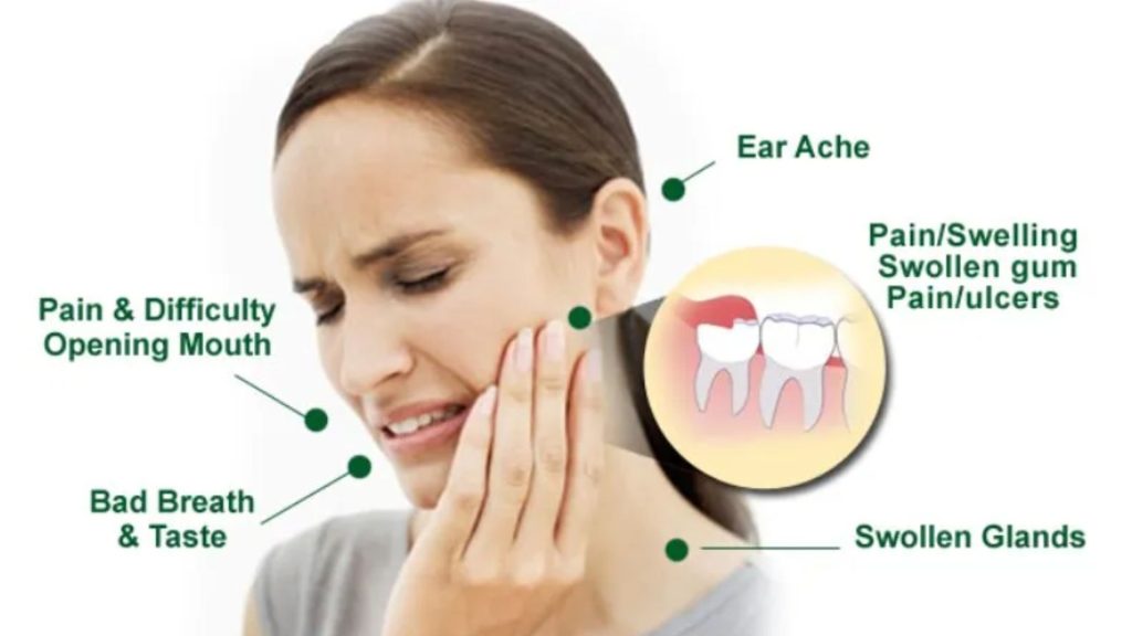 Wisdom Tooth Discomfort Symptoms Vary