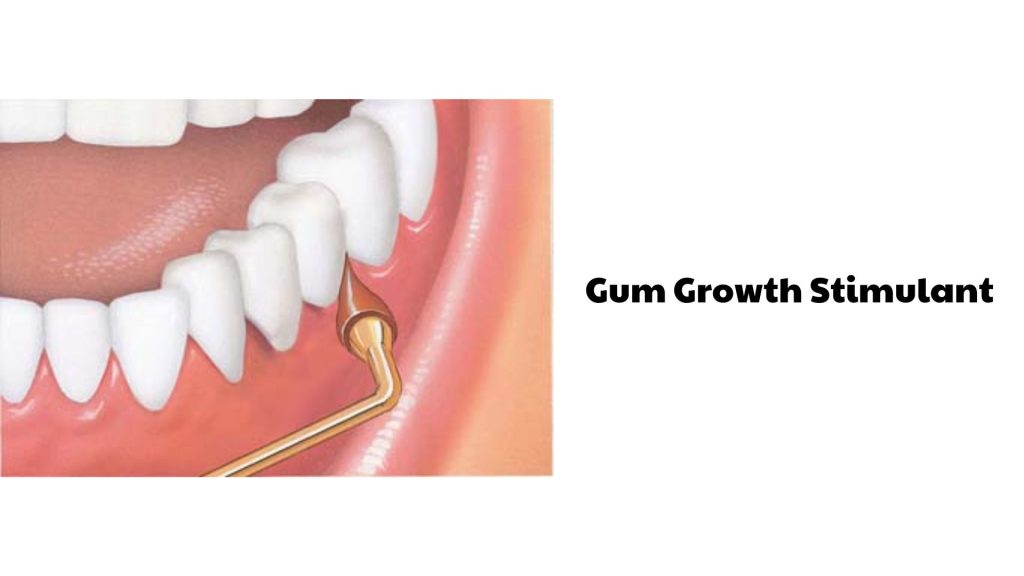 Gum Growth Stimulant