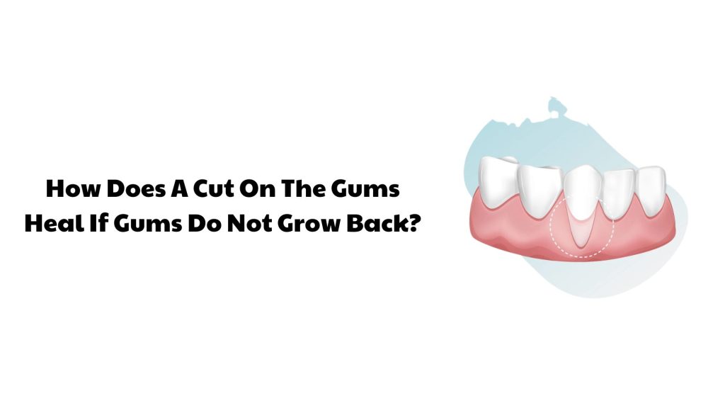 How Does A Cut On The Gums Heal If Gums Do Not Grow Back