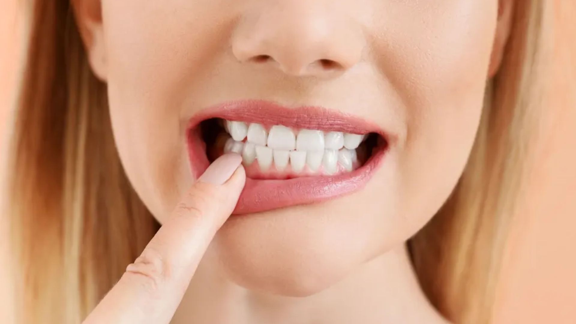 Tooth Enamel Loss Pictures Of Teeth Without Enamel Is Here
