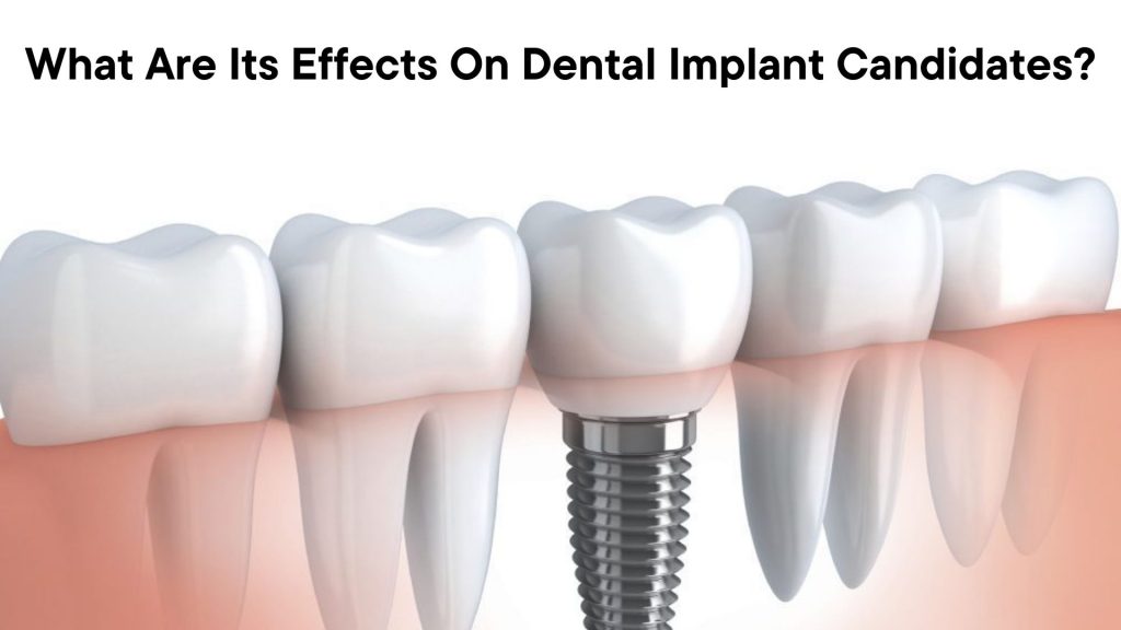What Are Its Effects On Dental Implant Candidates